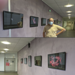 Photo du couloir de la clinique Claude Bernard pendant l'accrochage des photographies astronomiques de Corentin MARTINE